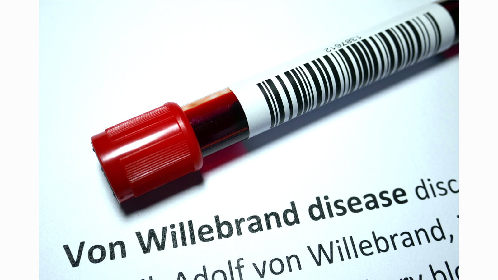 How Common Is Von Willebrand Disease